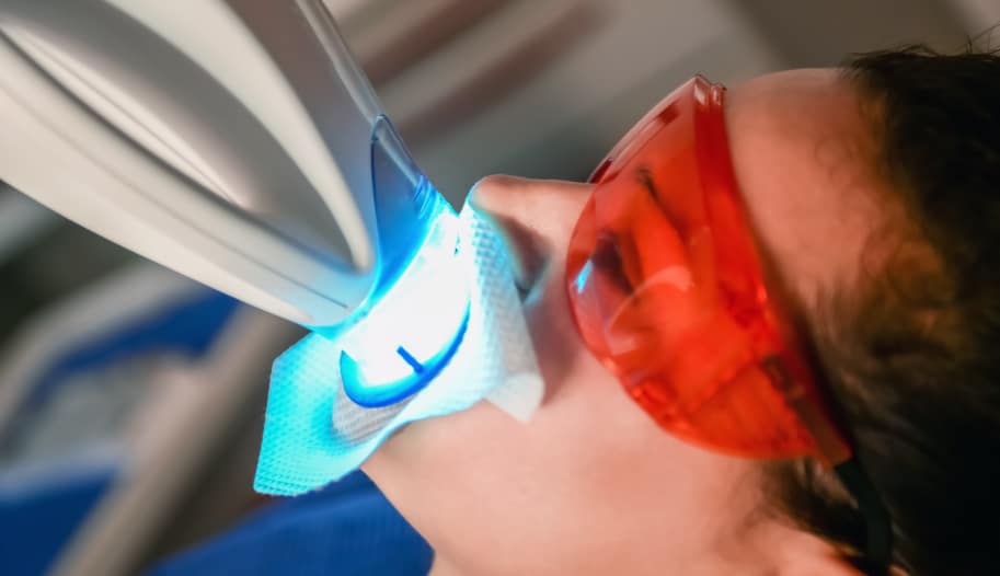 Zoom Whitening, teeth whitening