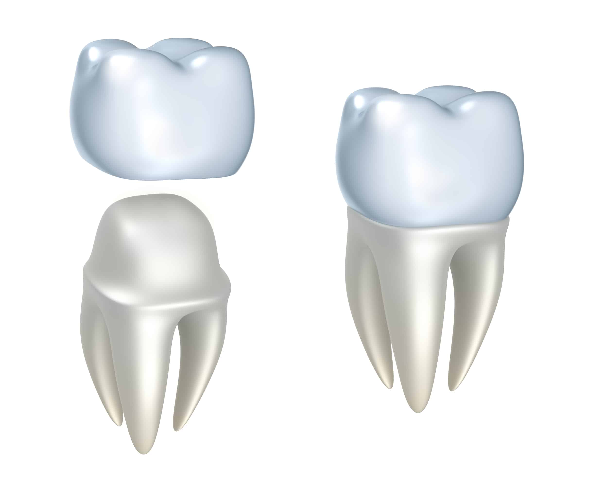About crowns for your teeth